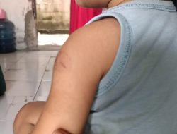 Tega, Balita Berumur 2 Tahun Dianiaya Ayah Tirinya di Kecamatan Karang Bahagia Kabupaten Bekasi