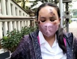 Seorang Wanita Ini Ditabrak Pacarnya hingga Terluka Lantaran Cemburu