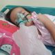Alea Yumna, Bocah 5 Tahun Asal Cianjur Penderita Hirschsprung Butuh Uluran Tangan Untuk Operasi Kedua