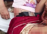 Diserang Delapan Anjing Liar Saat Pulang Sekolah, Pelajar 7 Tahun di Cianjur Alami Luka Serius
