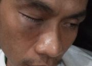 Host Night Run Ramadan Dikeroyok Orang Tak Dikenal, Polisi Didesak Usut Tuntas
