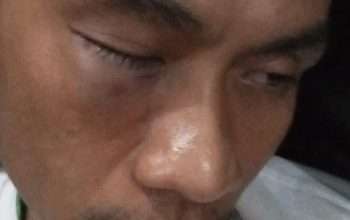 Host Night Run Ramadan Dikeroyok Orang Tak Dikenal, Polisi Didesak Usut Tuntas